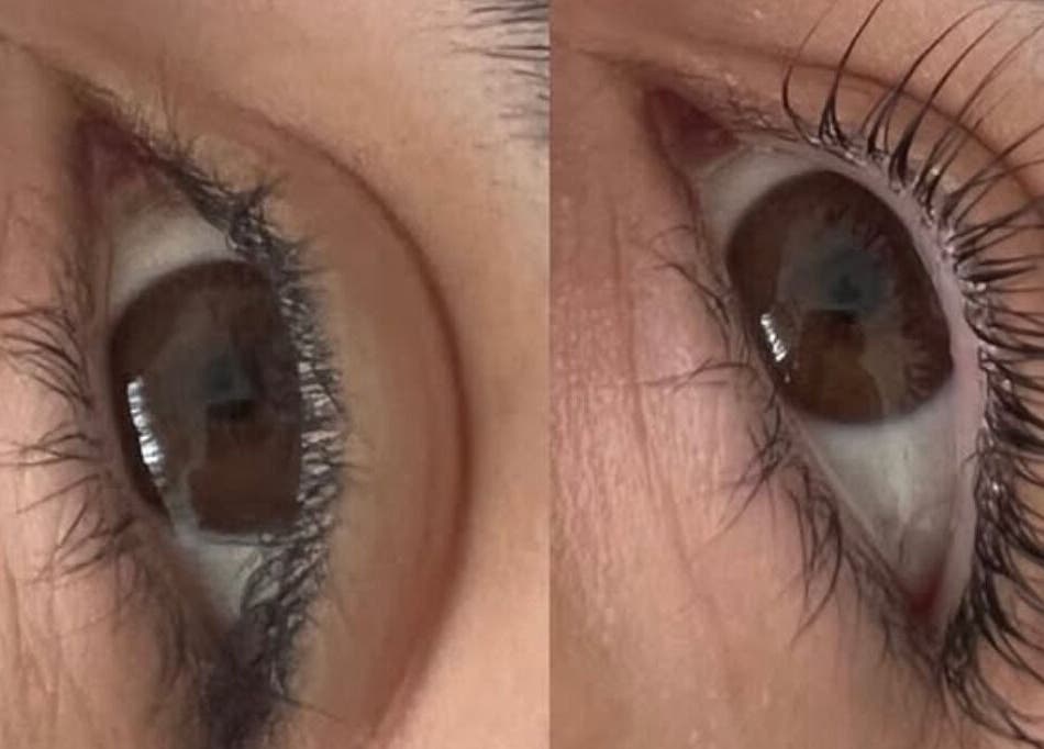 Close-up of eyelash enhancement service at The Glowing Complexions, Wanniassa, Australian Capital Territory, AU.