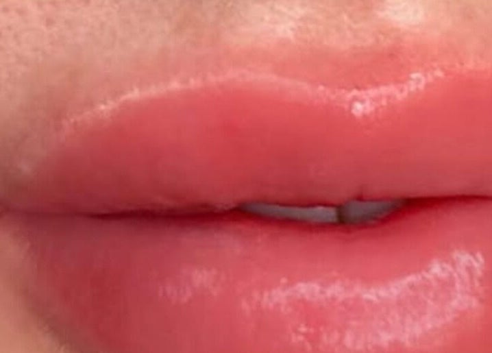 Close-up of glossy lips at The Glowing Complexions, Wanniassa, Australian Capital Territory, AU