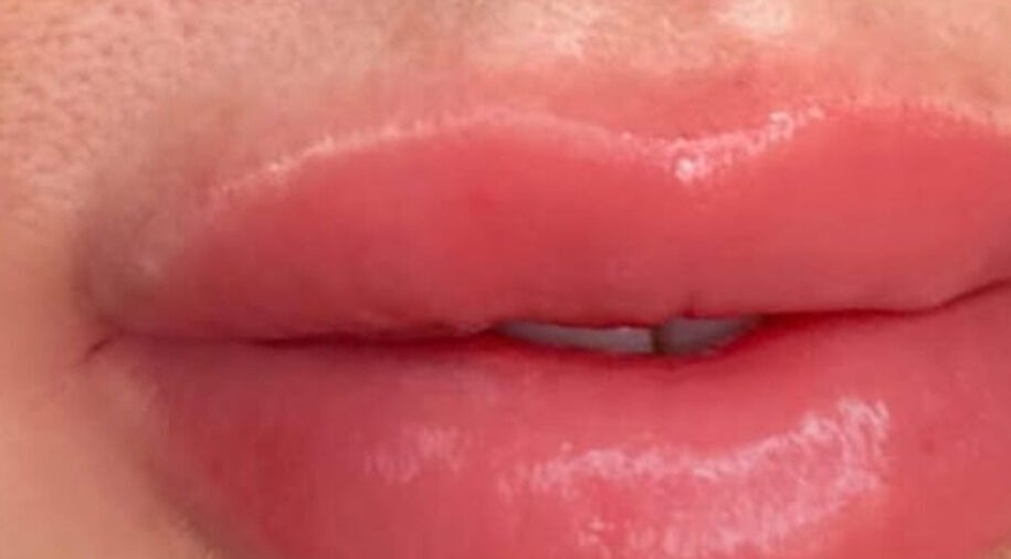 Close-up of glossy lips at The Glowing Complexions, Wanniassa, Australian Capital Territory, AU