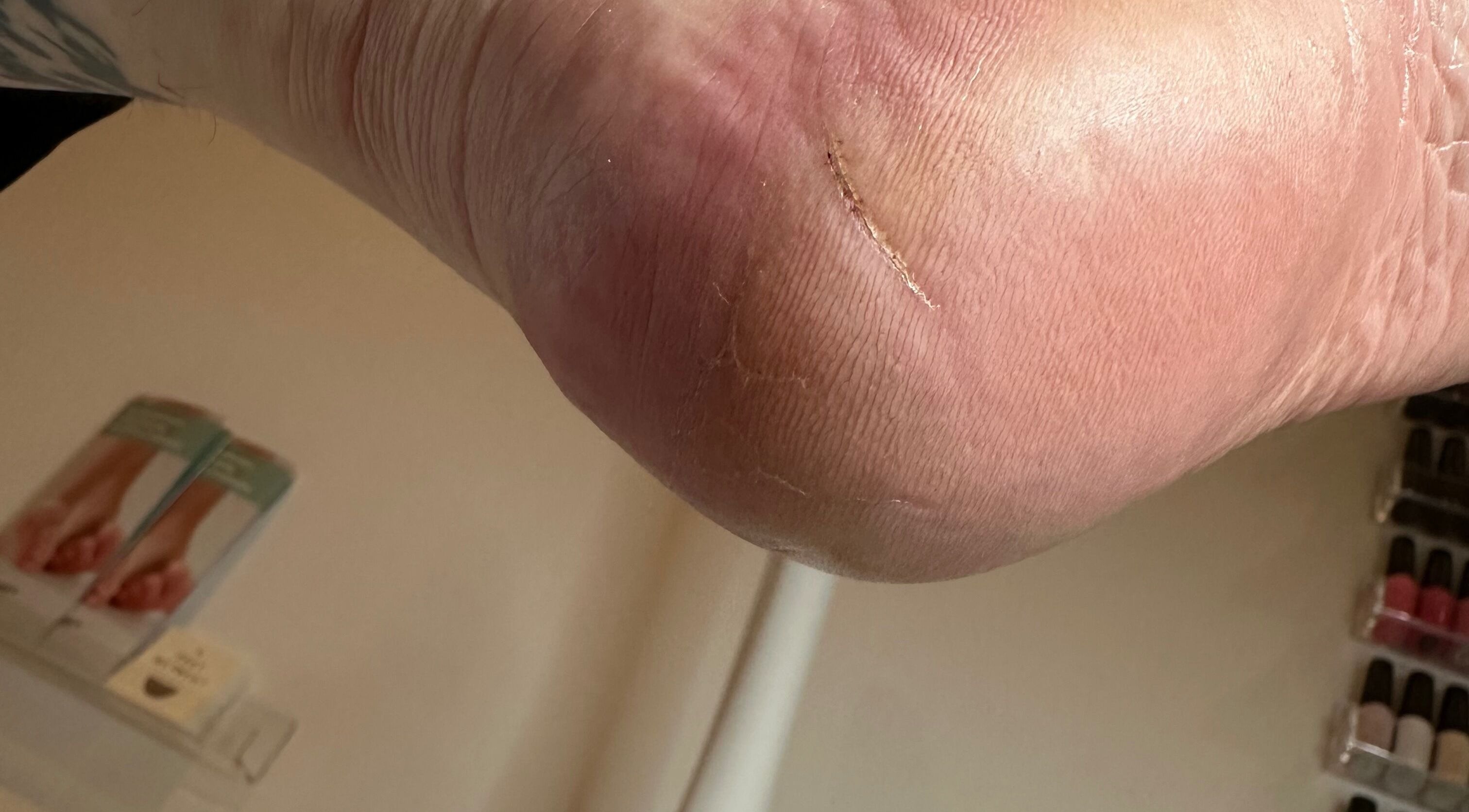 Close-up of a foot care session at Feet Retreat in Elgin, Scotland, GB, highlighting heel treatment.