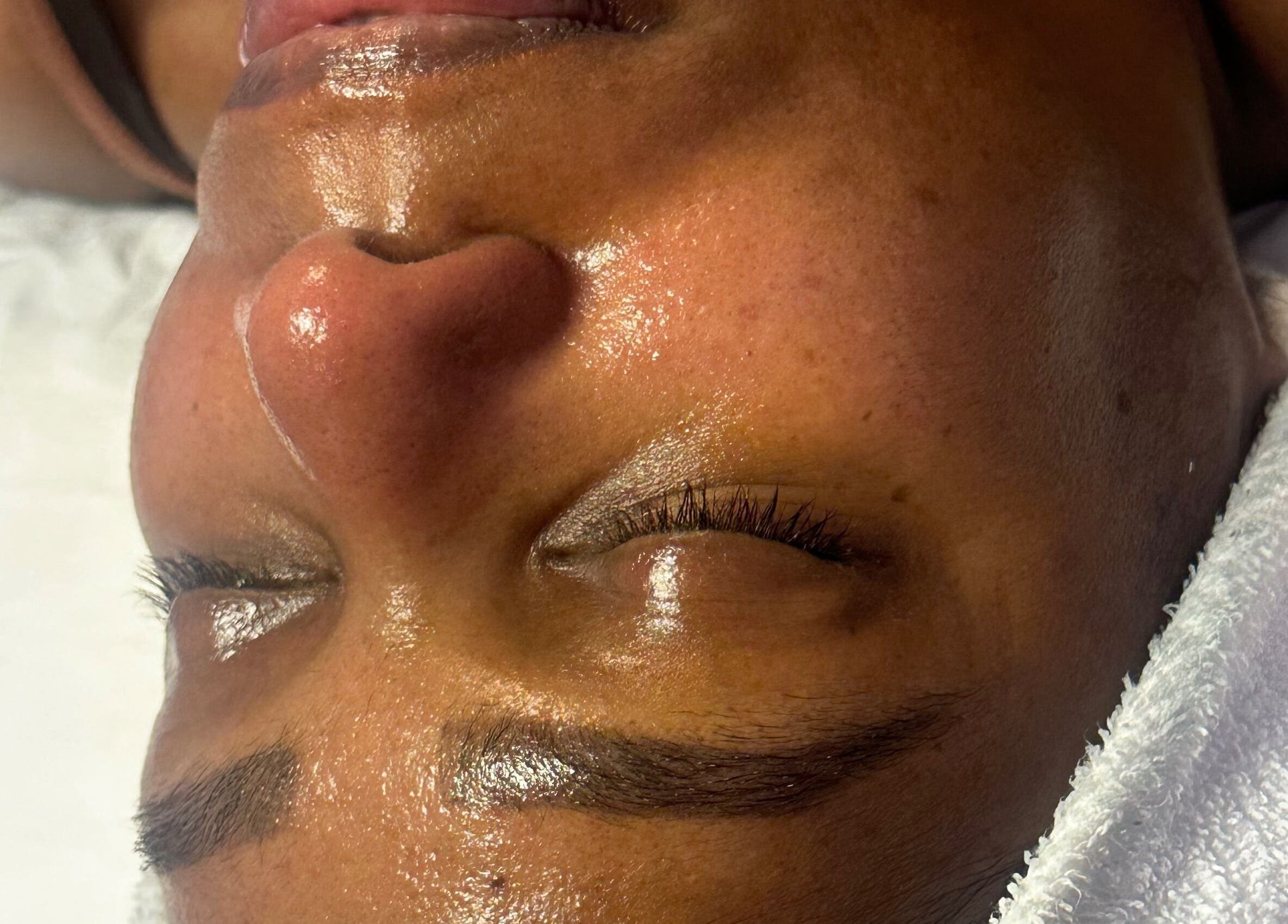 Facial treatment at Created by Lonna Skin and Body Spa, Belleville, New Jersey, US. Close-up of refreshed skin.