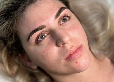 Close-up of a woman with perfect skin post-treatment at Simply Skin and Beauty, Alkimos, Western Australia, AU.