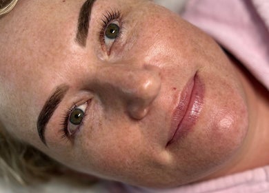 Close-up of a smiling woman showcasing beauty treatment at Simply Skin and Beauty, Alkimos, Western Australia, AU.