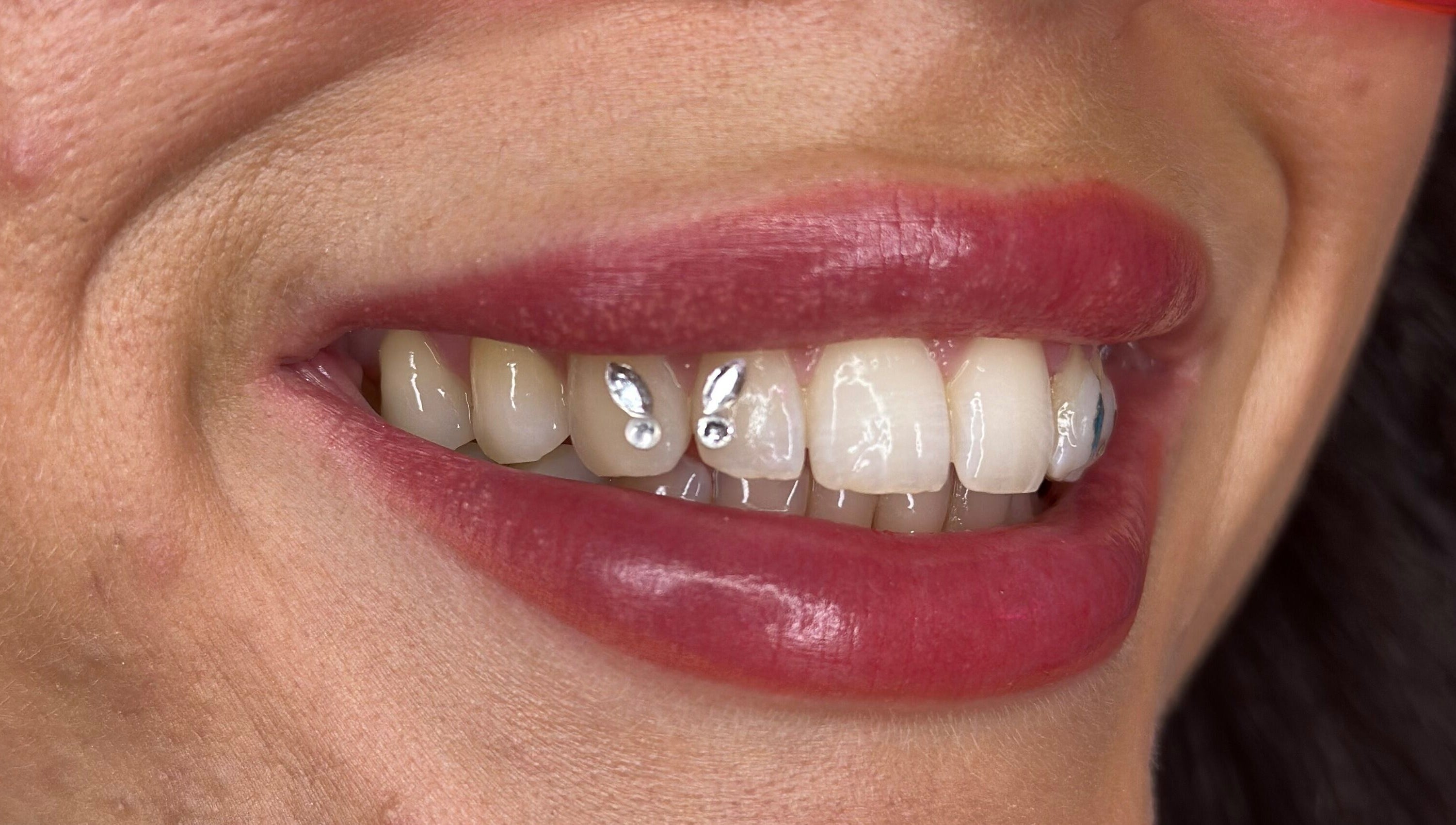 Close-up of a smile with pearly teeth and unique gems at Kglowstudio, London, England, GB.