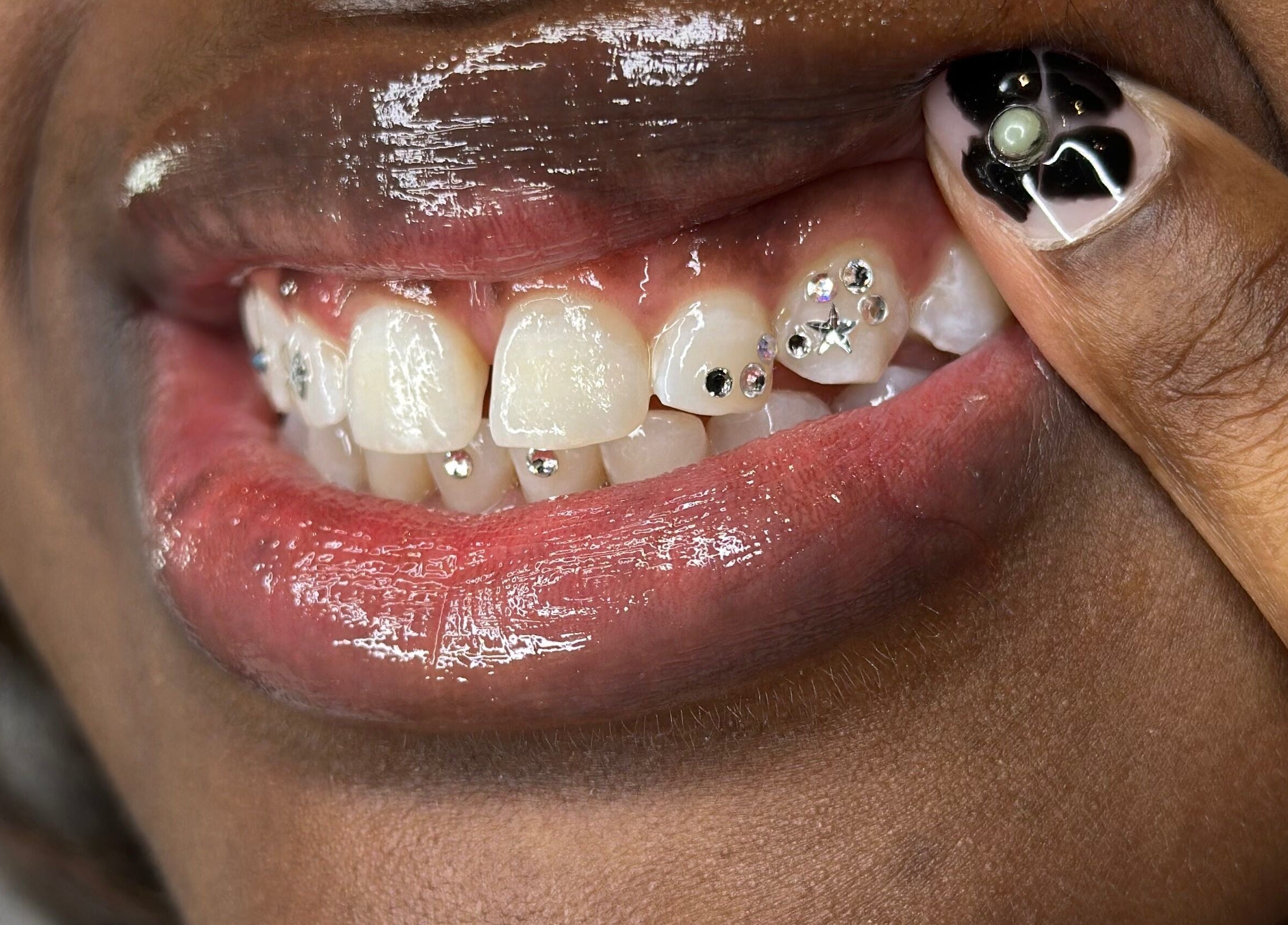 Close-up of gemstone tooth art at Kglowstudio, London, England, GB.