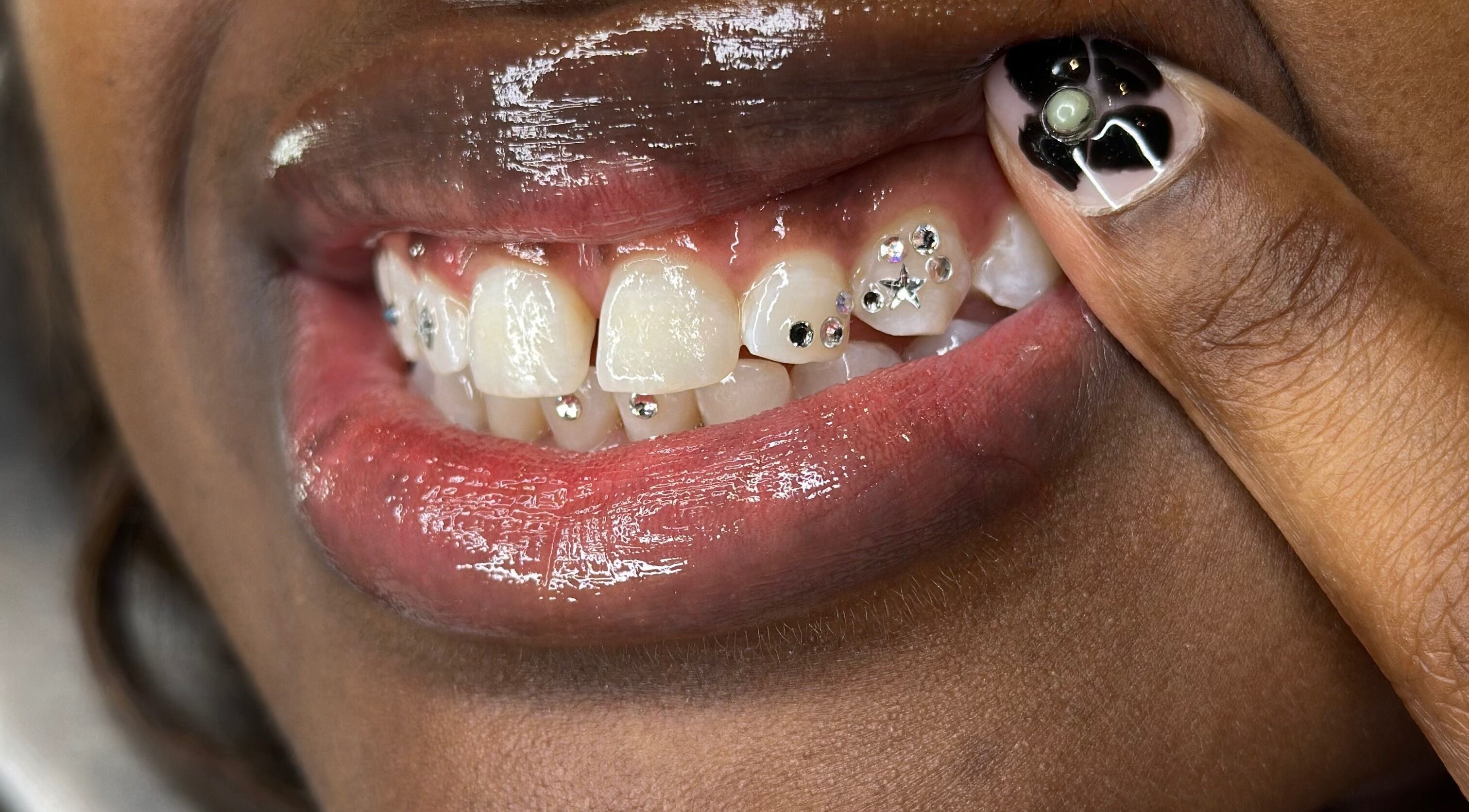 Close-up of gemstone tooth art at Kglowstudio, London, England, GB.