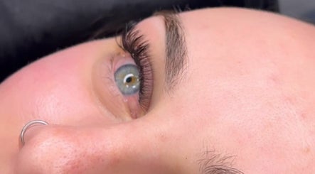 Eyeco Aesthetics 3paveikslėlis