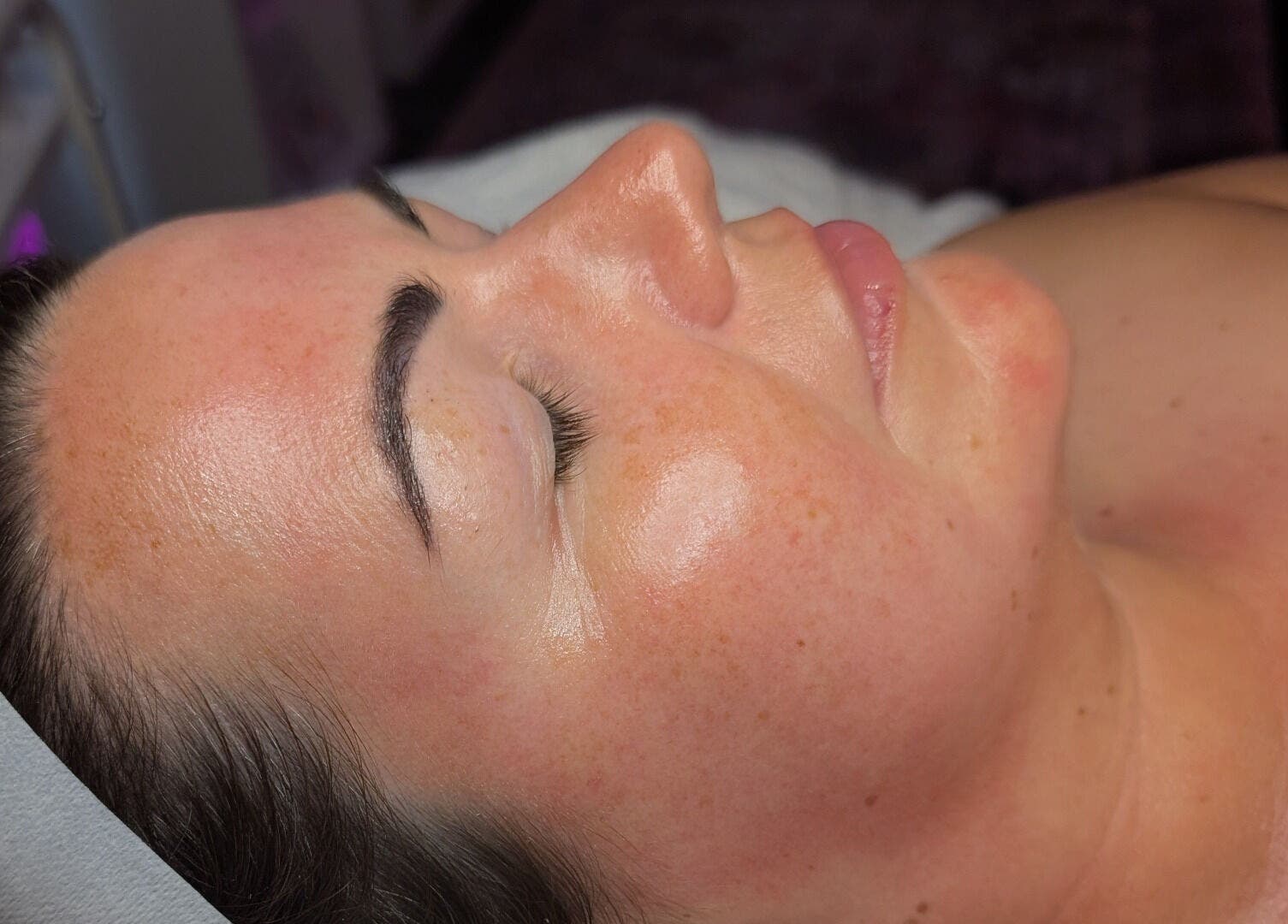 Close-up of a client's radiant skin at Skinfit Studio, Shifnal, England, GB illustrating beauty treatment results.