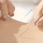 Dr. Song Acupuncture & Massage Clinic on Fresha - 245, 9750 51 Ave Edmonton, Edmonton, Alberta