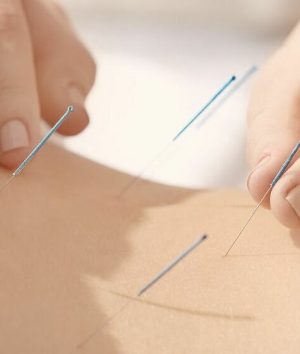 Dr. Song Acupuncture and Massage Clinic imagem 2
