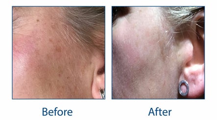 Flawless Aesthetics, Skin Rejuvenation, Laser Hair Removal & Permanent MakeUp – kuva 2