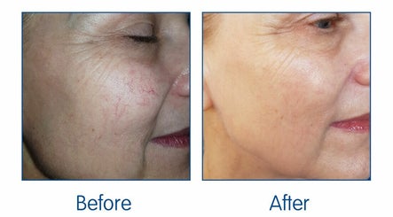Flawless Aesthetics, Skin Rejuvenation, Laser Hair Removal & Permanent MakeUp image 3