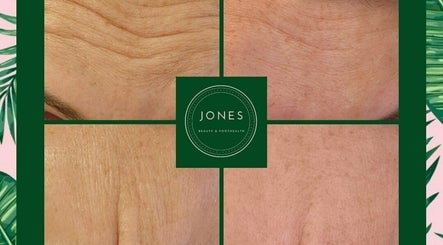 Jones - Beauty & Aesthetics изображение 3
