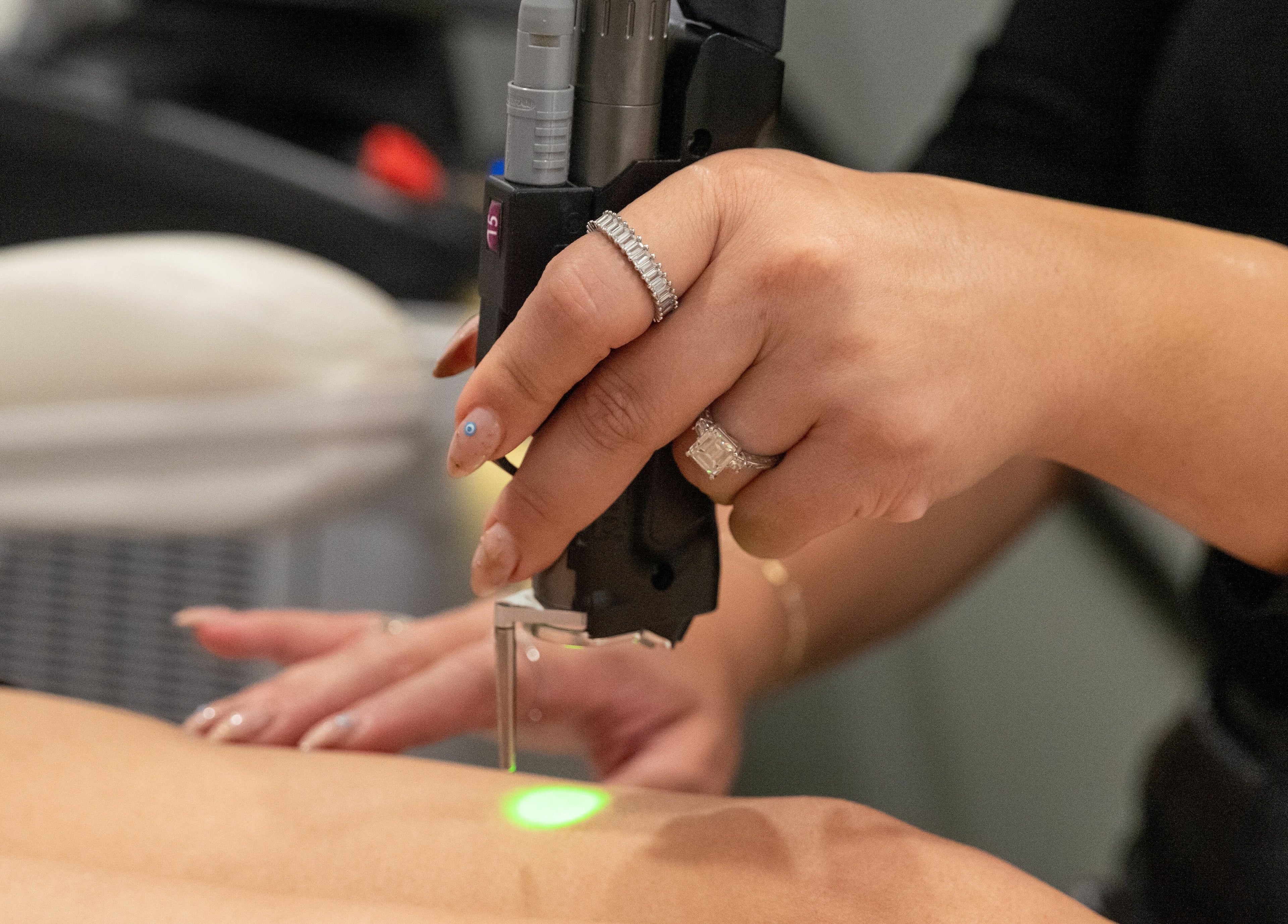 Laser hair removal at Elysian Beauty Bar Inc, Windsor, Ontario, CA.