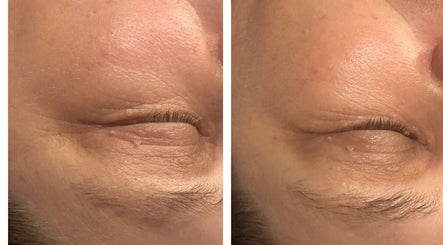 Amethyst Ageless Studio, bild 2