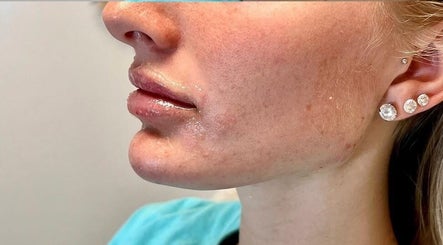 Close-up of glowing skin post-treatment at Nu Skin Clinic, London, England, GB.