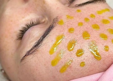 Facial treatment at Nu Skin Clinic, London, England, GB, showcasing skincare application.