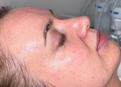 Facial beauty treatment at Lish Brows & Beauty By Lauryn Robin in Glasgow, GB, highlighting skin radiance.