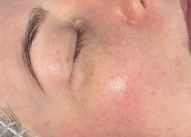 Close-up of glowing skin after treatment at Lish Brows & Beauty By Lauryn Robin, Glasgow, GB.