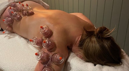 Cupping therapy session at Kings Sutton Sports Therapy, Kings Sutton, England, GB.