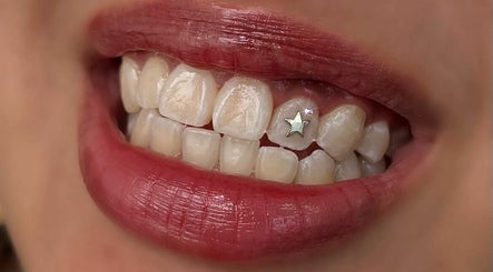 Dazzle Teeth, bild 2