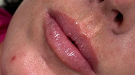 Cricklade Aesthetics Clinic - Cirencester image 3