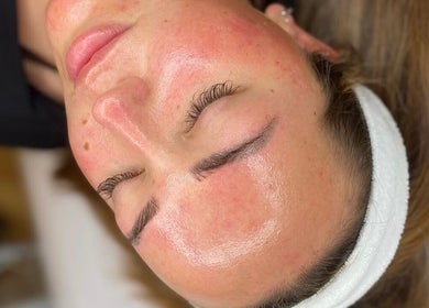 Close-up of a client's radiant facial skin at Glow Skin Bar, Newcastle, England, GB.
