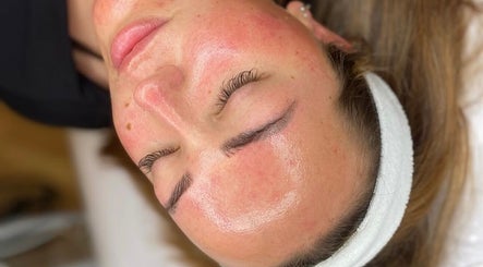 Close-up of a client's radiant facial skin at Glow Skin Bar, Newcastle, England, GB.