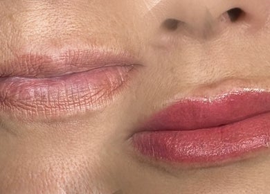 Lip enhancement treatment before and after from Cosmopolitan Beauty Bar, Springwater, Ontario, CA.