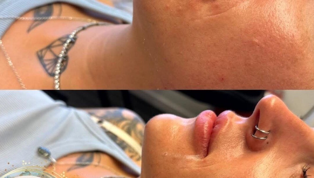 Before and after facial at Aquarius Artistry and Aesthetics, Springside, Scotland, GB, showing rejuvenated skin glow.