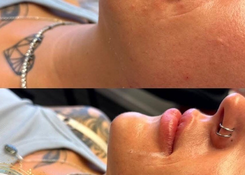 Before and after facial at Aquarius Artistry and Aesthetics, Springside, Scotland, GB, showing rejuvenated skin glow.