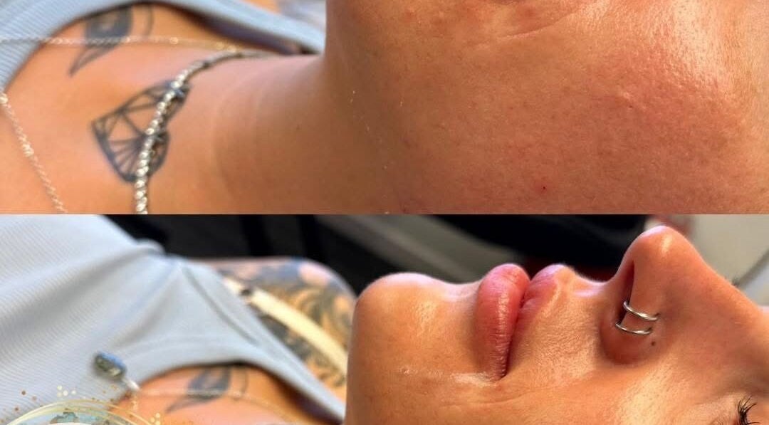 Before and after facial at Aquarius Artistry and Aesthetics, Springside, Scotland, GB, showing rejuvenated skin glow.