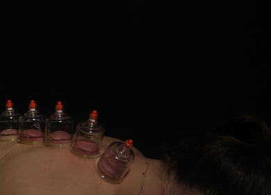Cupping therapy session at Intuitive Bodywork, Rickmansworth, England, GB for relaxation and wellness.