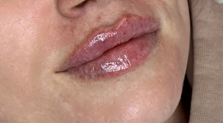 T M Beauty and Aesthetics image 3
