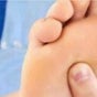 Redditch Footcare Surgery and Mole Removals