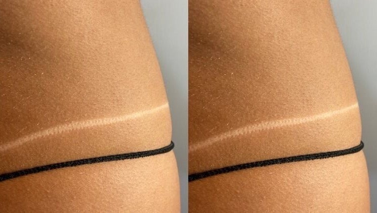 Immagine 1, Sienna and B Spray Tan Specialist