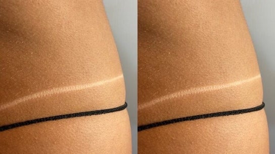 Sienna and B Spray Tan Specialist