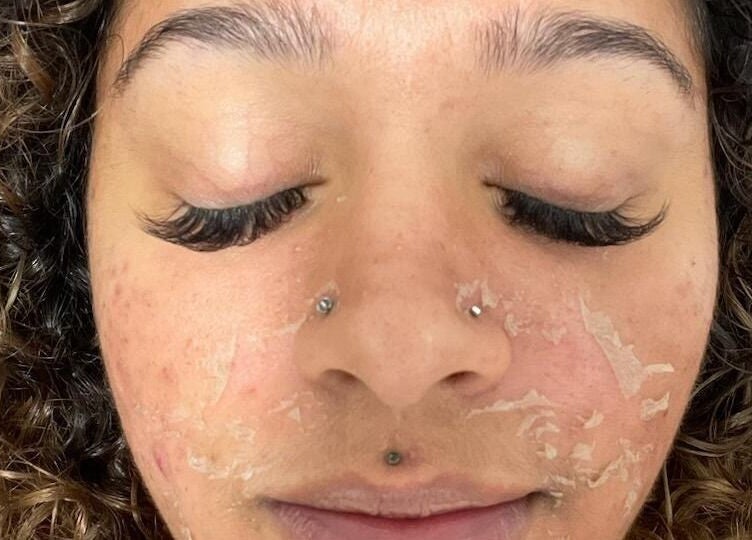 Facial treatment at The SkinCare Connection, Skin and Lash spa in Bensalem, Pennsylvania, US.