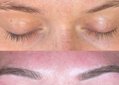 Before and after eyebrow styling at Glow Beauty and Aesthetics in Newhall, England, GB.