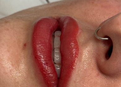 Close-up of enhanced red lips at JM Cosmetics & Skin Clinic, Penarth, Wales, GB.