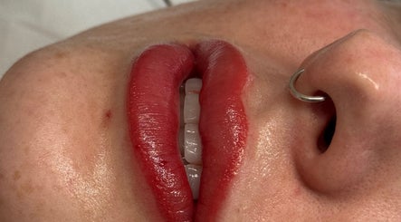 Close-up of enhanced red lips at JM Cosmetics & Skin Clinic, Penarth, Wales, GB.