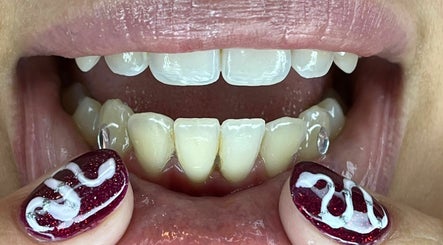 Bg.mess - Piercings and Tooth Gems  image 2