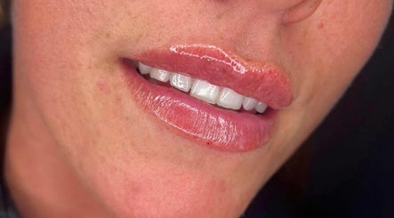 Mo-Co Aesthetics Clinic image 3