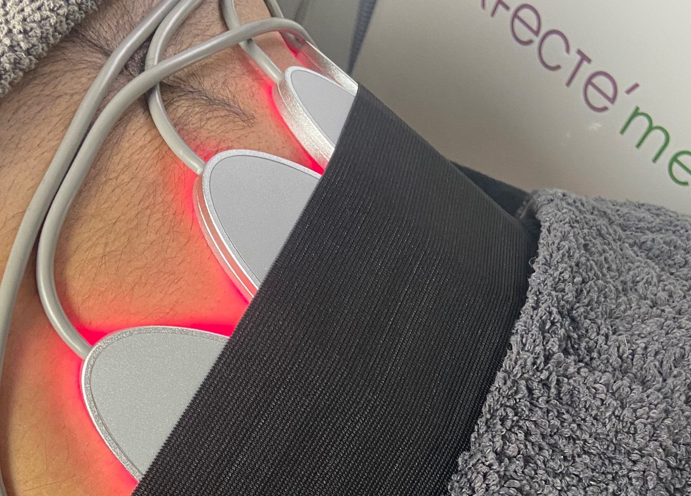 Laser treatment in progress at At1.Aesthetics, Nottingham, England, GB, showing a glowing red device on skin.