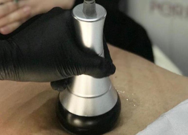 Body contouring treatment at At1.Aesthetics, Nottingham, England, GB using advanced equipment.