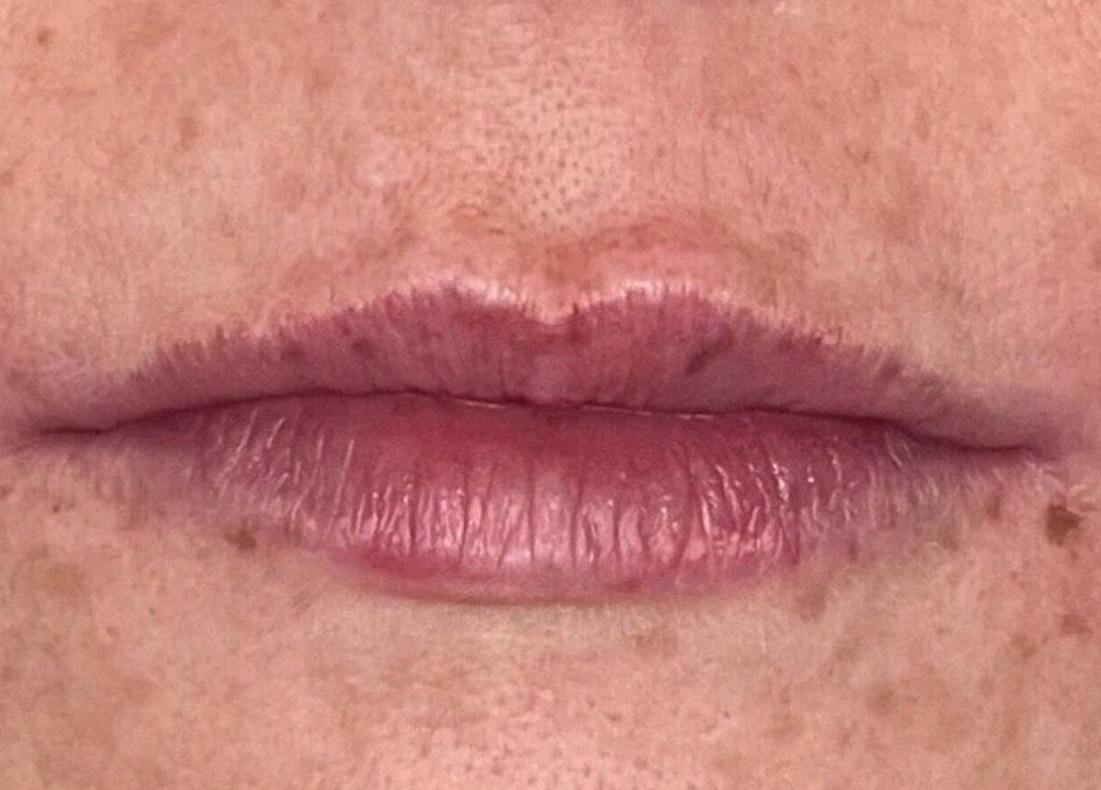 Close-up of natural lips at Oxley Aesthetics, Hemel Hempstead, England, GB, highlighting beauty services.