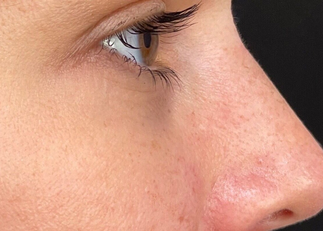 Close-up of radiant skin at Oxley Aesthetics, Hemel Hempstead, England, GB.