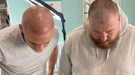 Scalp micropigmentation at Tiffany MacDonald - Permanent Make-Up, Weybridge, England, GB. Two clients, impressive results.