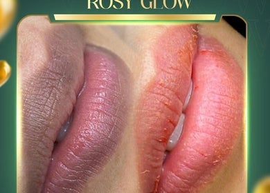 Before and after lip enhancement at Vy Brows Academy, Houston, Texas, US, featuring vibrant rosy glow.