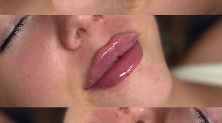 Lips with glossy finish at Enhancedbyabi, Brighton And Hove, England, GB, showcasing beauty enhancement.